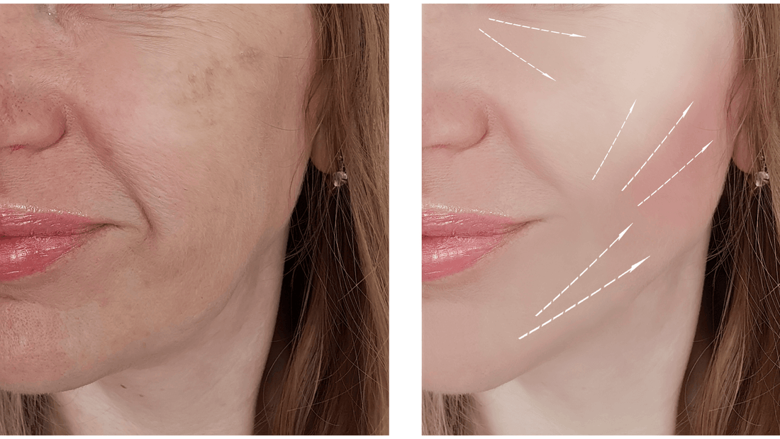 masque anti age