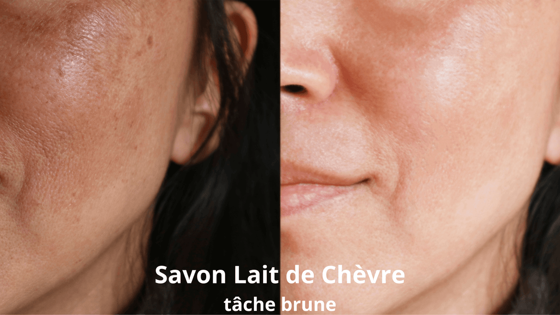 savon lait de chevre tache brune
