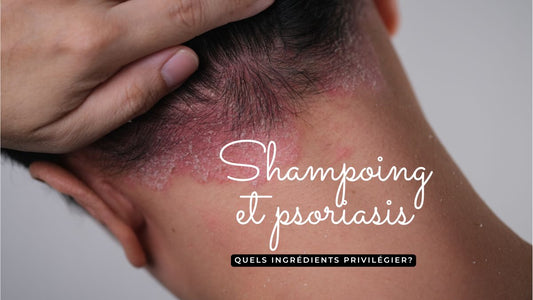 Shampoing et psoriasis: quels ingrédients privilégier?