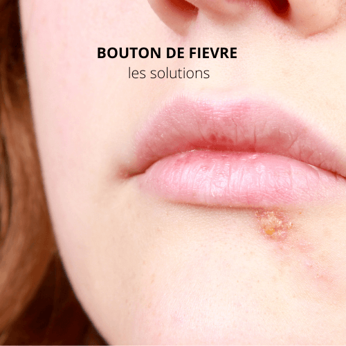 bouton de fievre