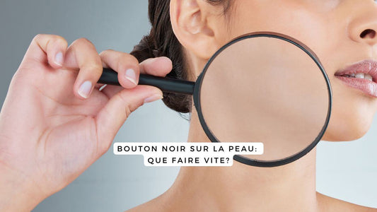 Bouton noir sur la peau: que faire vite?