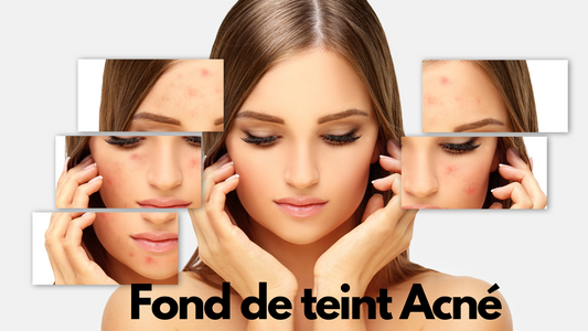 Fond de teint acné