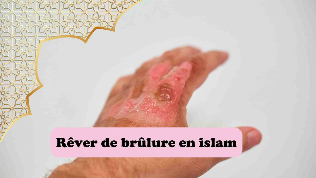 Rêver de brûlure en islam