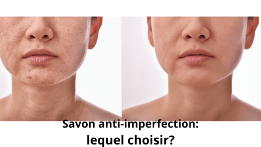 savon anti imperfection
