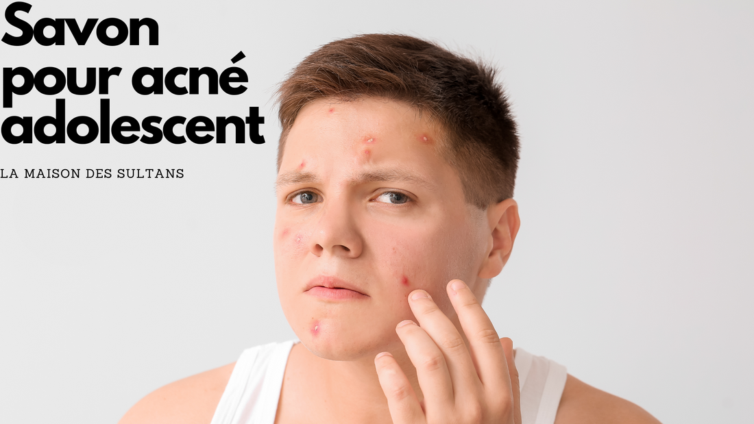 Savon pour acné adolescent
