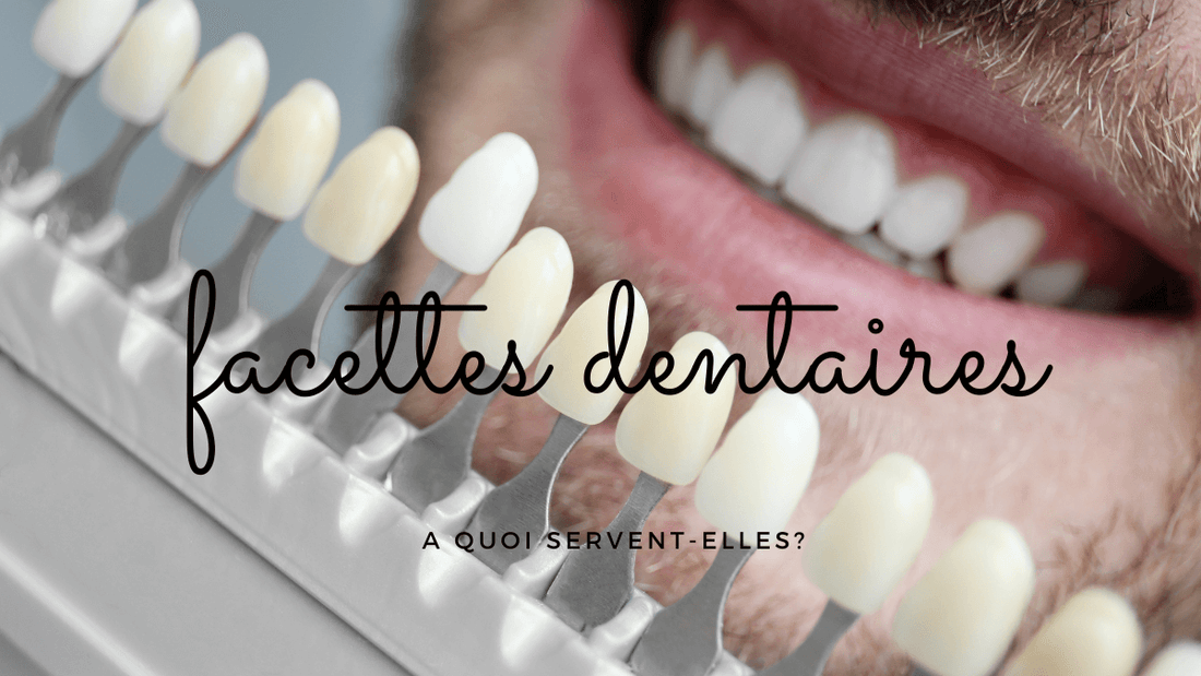 A quoi servent des facettes dentaires?