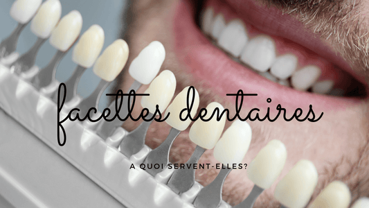 A quoi servent des facettes dentaires?