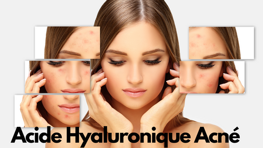 Acide hyaluronique acné