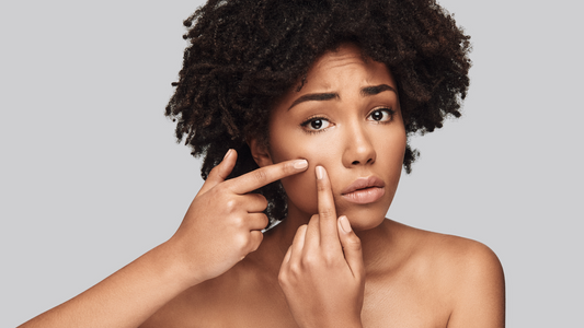 Acné peau noire: les solutions