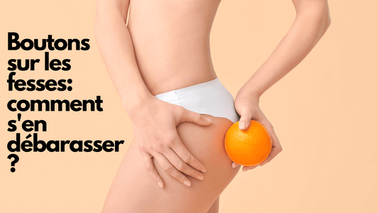 Boutons sur les fesses: comment s'en débarasser?