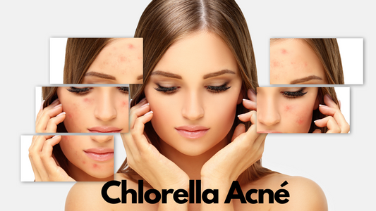 Chlorella acné