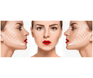 Cicatrice mini lifting visage