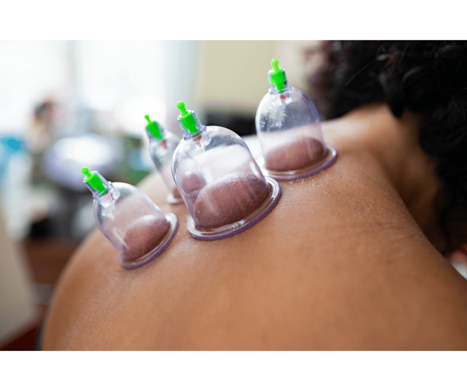 hijama paris