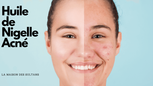 Huile de nigelle acné: une solution?