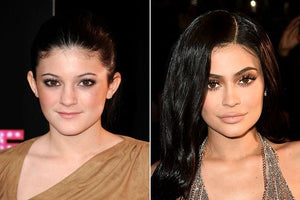 Kylie Jenner avant après