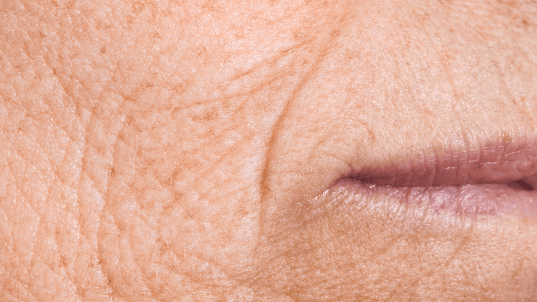 Remède de grand-mère ride autour de la bouche