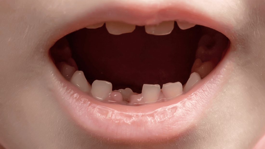 Rever de perdre ses dents en islam