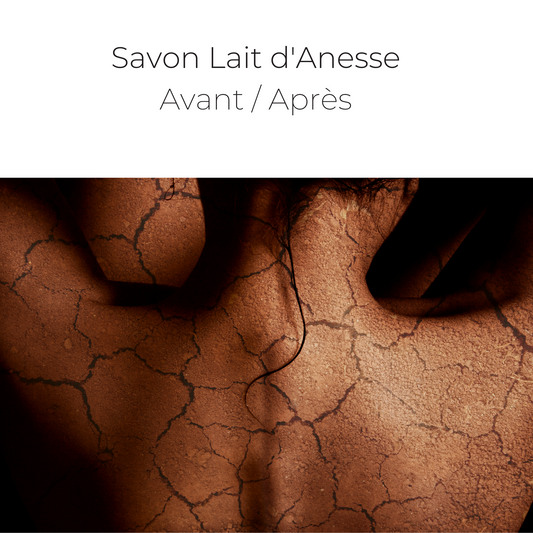 savon lait d'anesse avant apres